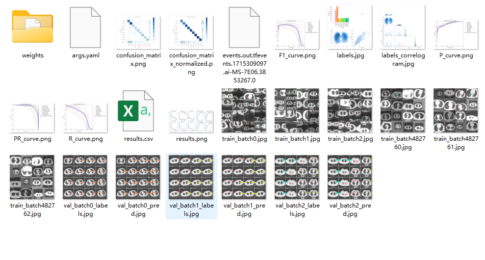 Yolov8医学肺影像CT模型训练结果可视化图分析与评估训练结果